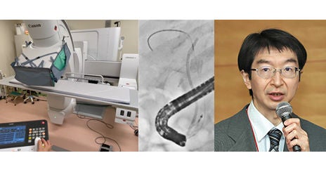 C アームの角度調整と新画像処理条件を駆使したERCP 関連手技