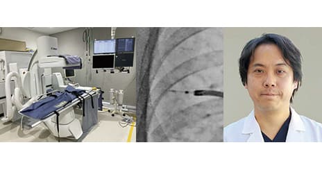 X線透視システムの最大活用 ～導入から実践まで～