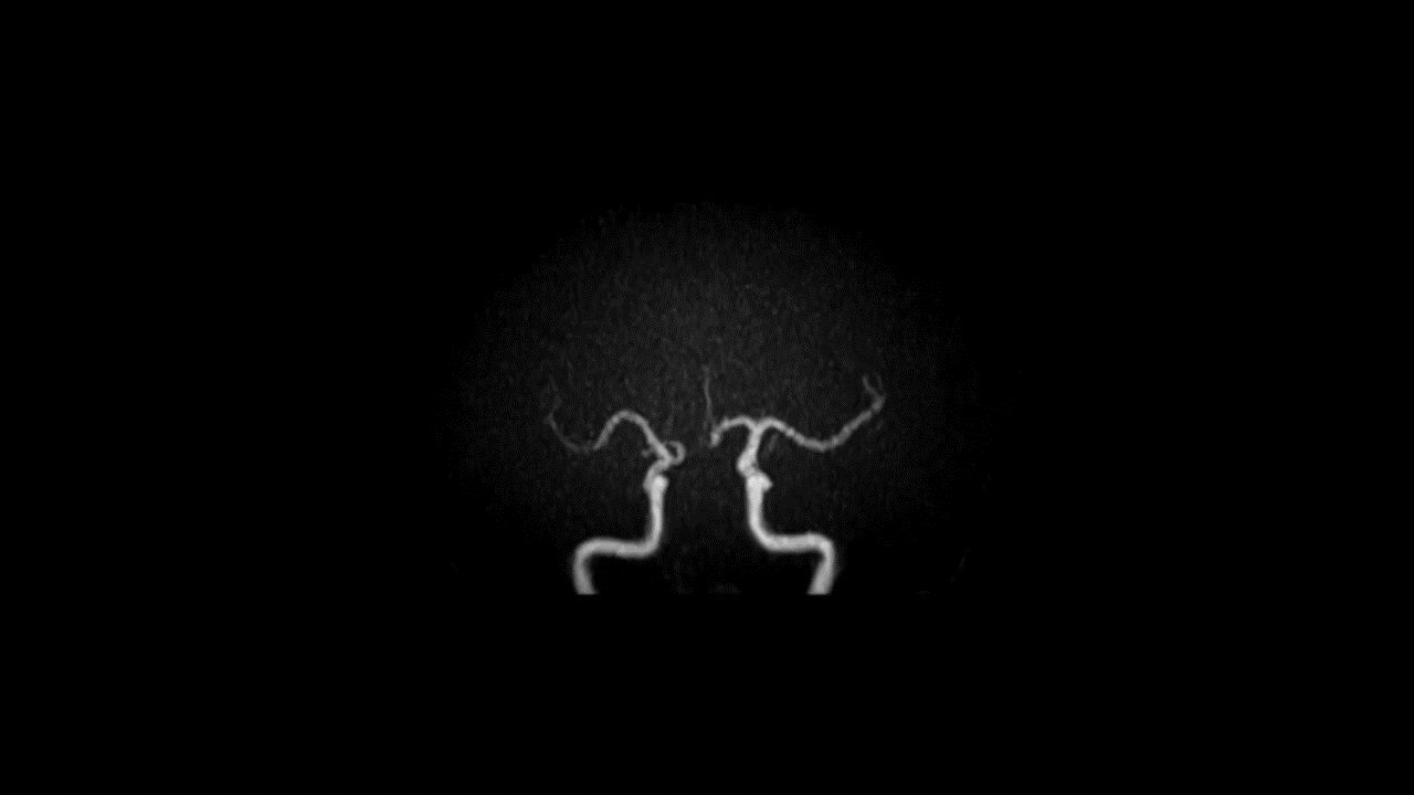 GIF