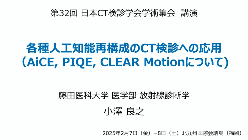 各種人工知能再構成のCT検診への応用: AiCE, PIQE, CLEAR Motionについて