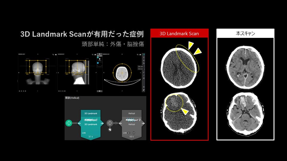 Aquilion ONE N-UXシリーズ | CT（Computed Tomography） | キヤノン