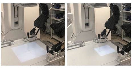 泌尿器領域におけるX線診断透視装置「Astorex i9」の使用経験