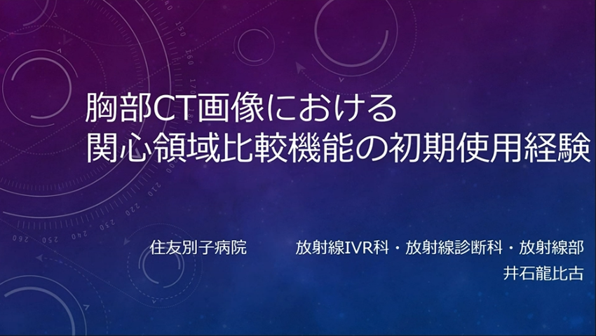 胸部CT画像における関心領域比較機能の初期使用経験