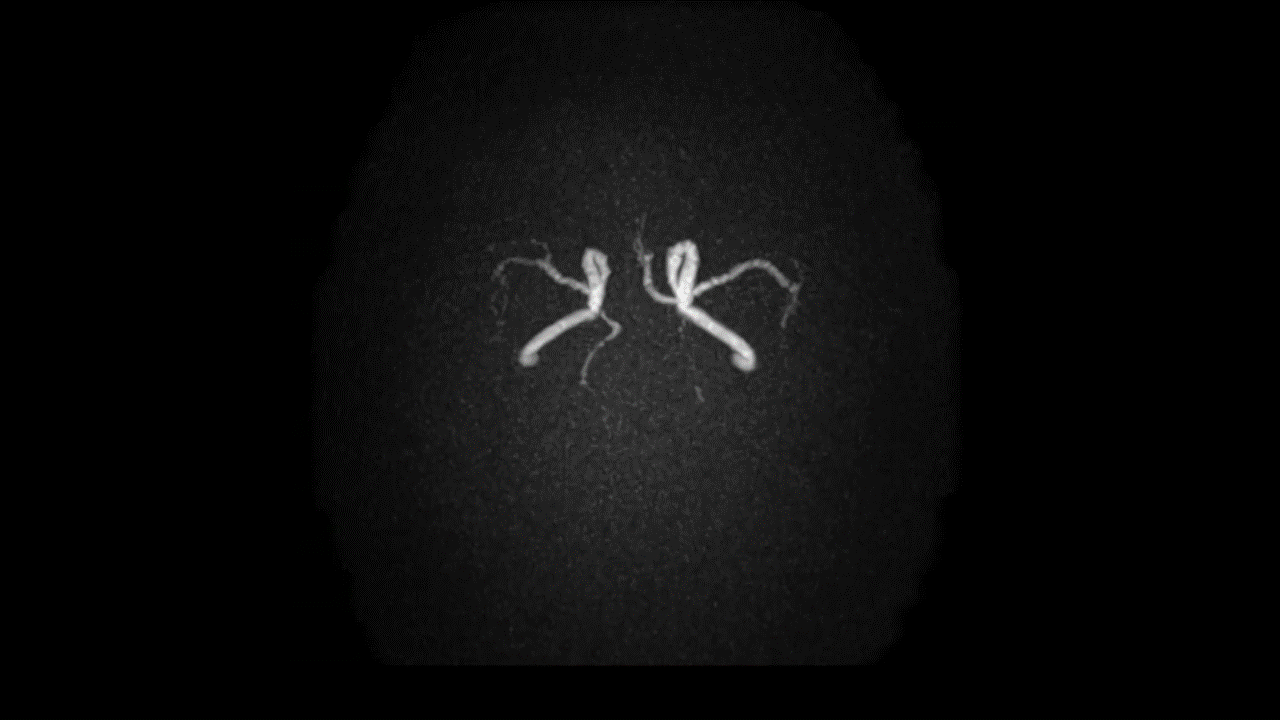 GIF