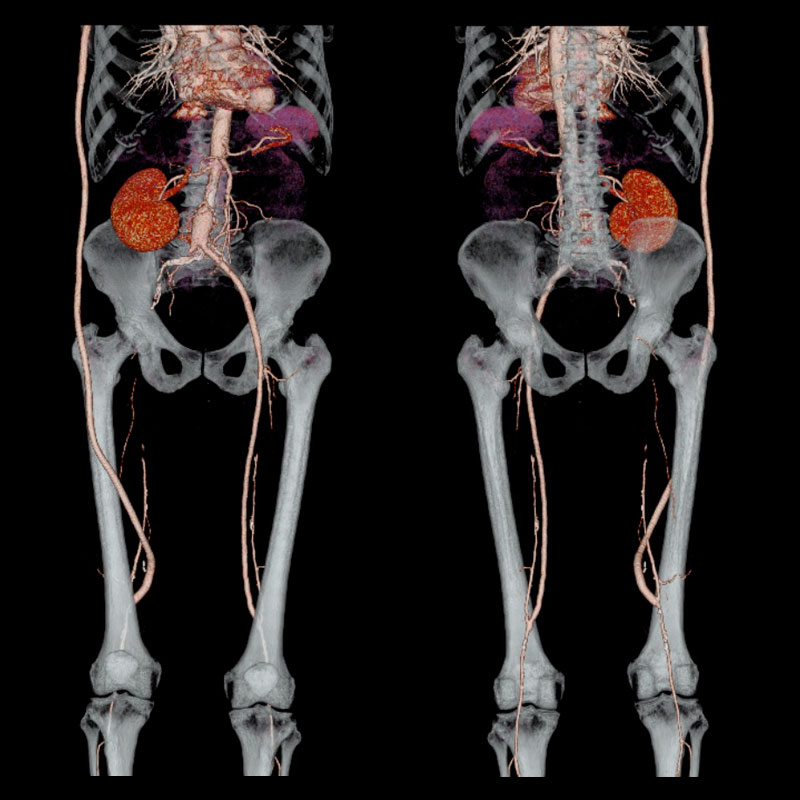 Aquilion Lightning Body 1