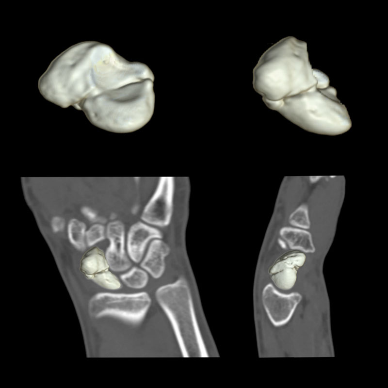 Aquilion Lightning Musculoskeletal 1