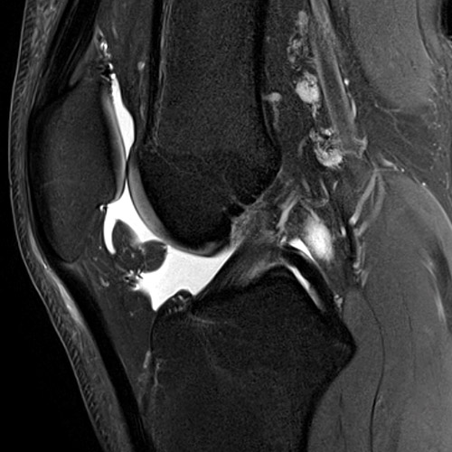 SportsMed Knee MRI 2