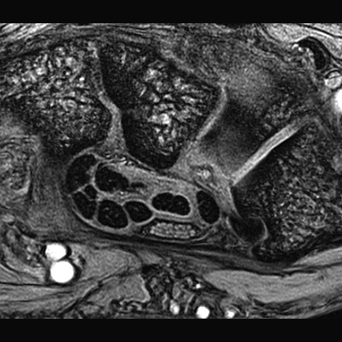 SportsMed Wrist MRI 1