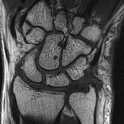 SportsMed Wrist MRI 2