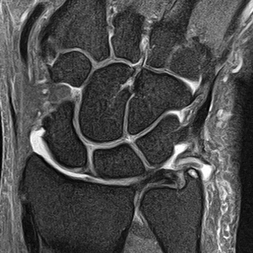SportsMed Wrist MRI 3