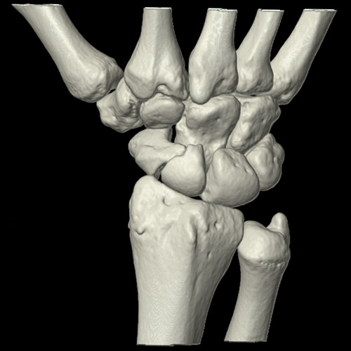 SportsMed Wrist CT