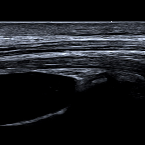 SportsMed Wrist Ultrasound // Long view 2