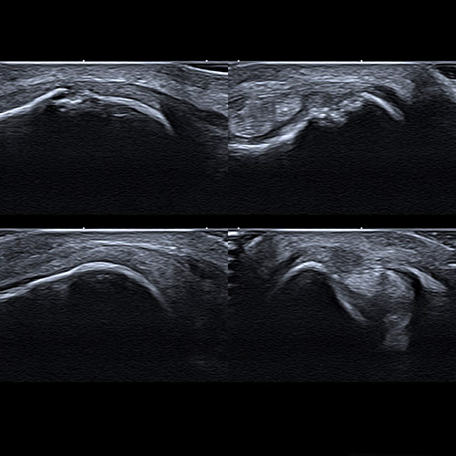 SportsMed Wrist Ultrasound // Quad view