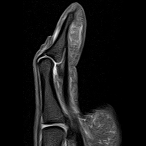 SportsMed Hand MRI
