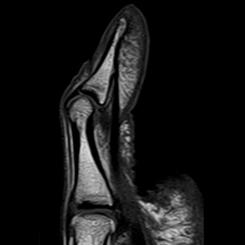 SportsMed Hand MRI
