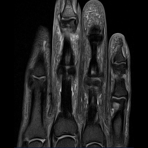 SportsMed Hand MRI