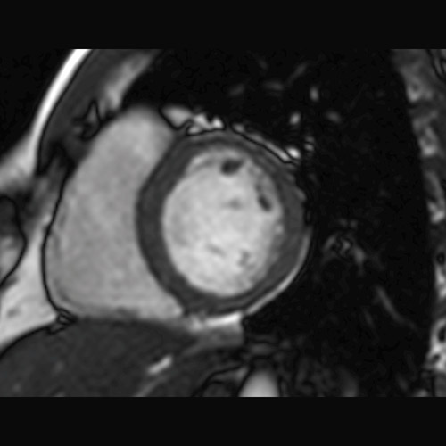SportsMed Heart MRI 1
