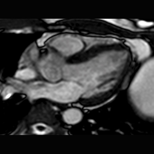 SportsMed Heart MRI 2