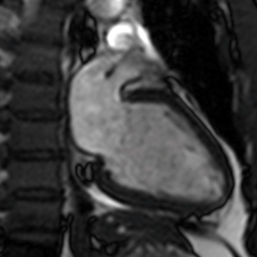 SportsMed Heart MRI 3
