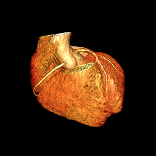 SportsMed Heart MRI 4