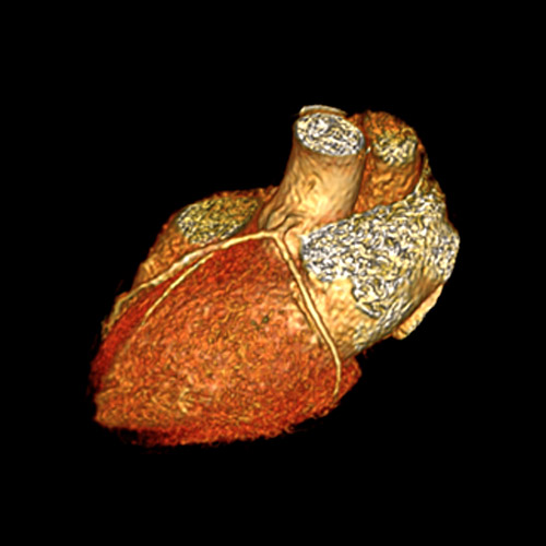 SportsMed Heart MRI 4