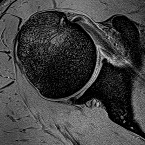 SportsMed Shoulder 1