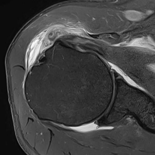 SportsMed Shoulder 2