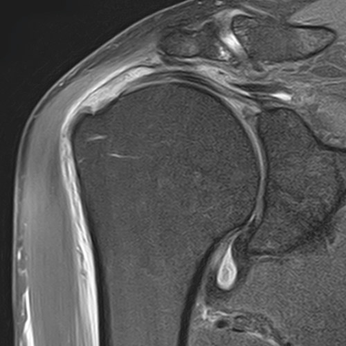 SportsMed Shoulder 2