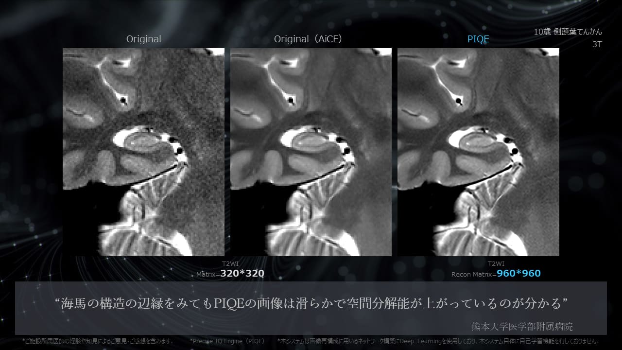 Piqe Clinical Gallery Head & Neck