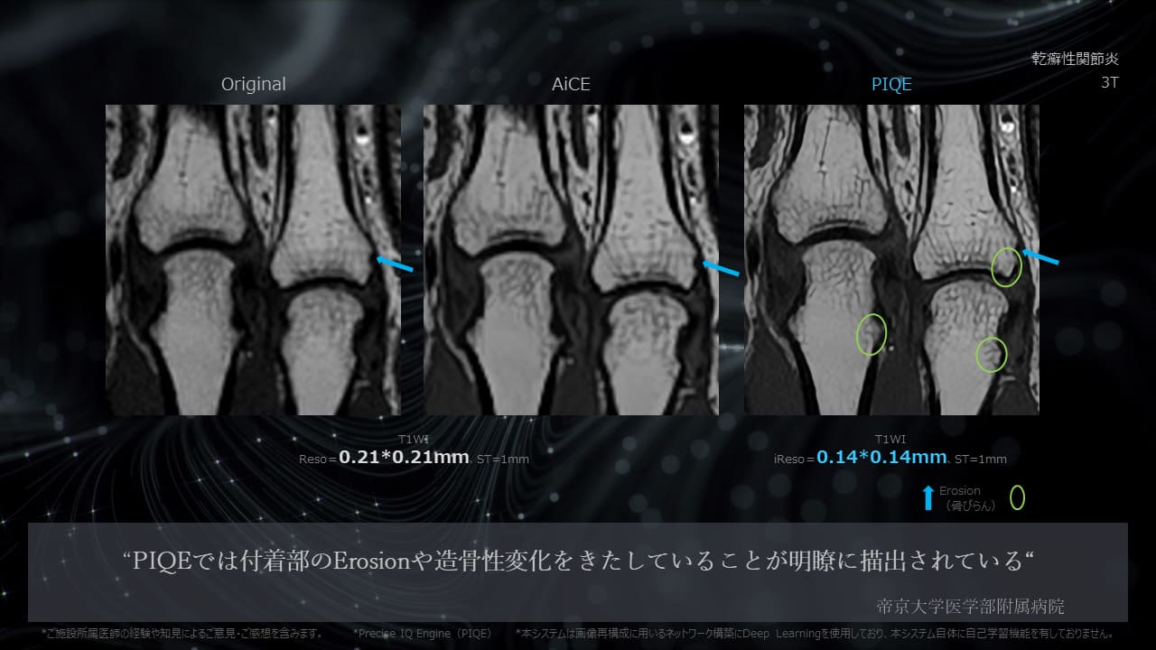 Piqe Clinical Gallery Orthopedic