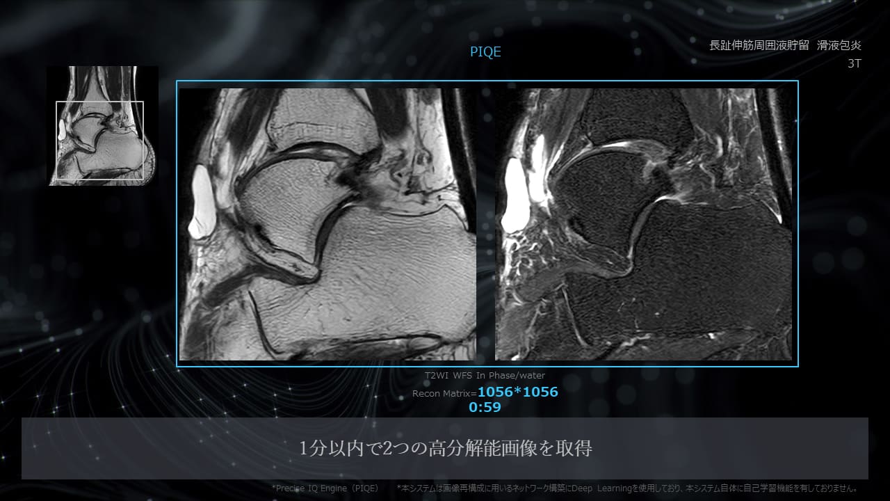Piqe Clinical Gallery Orthopedic